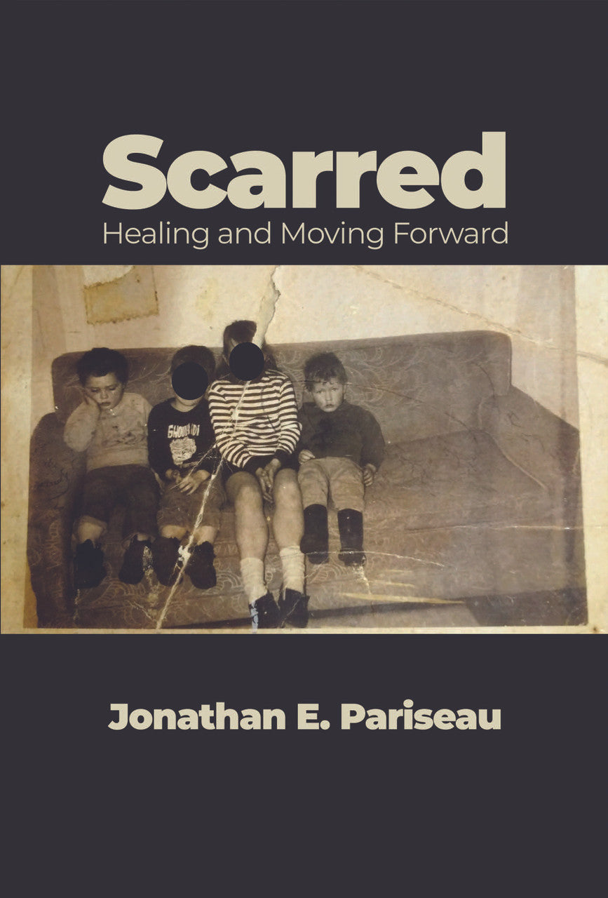 Scarred: Healing And Moving Forward